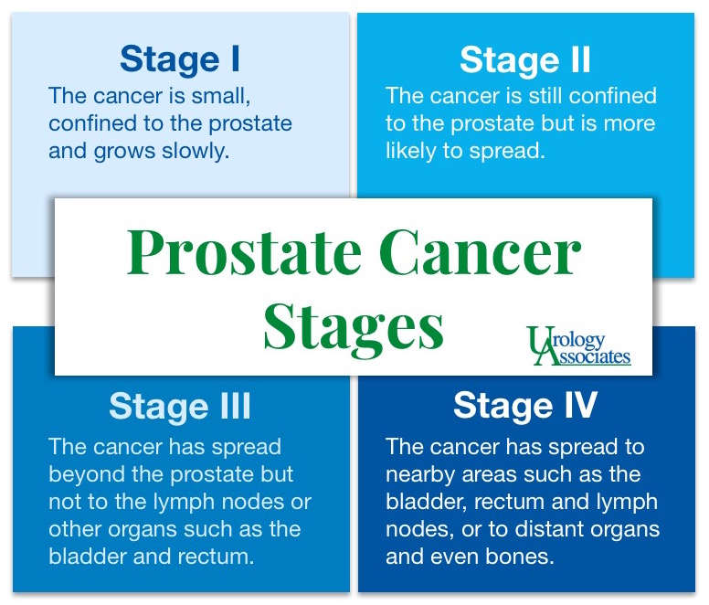 prostate cancer stages)